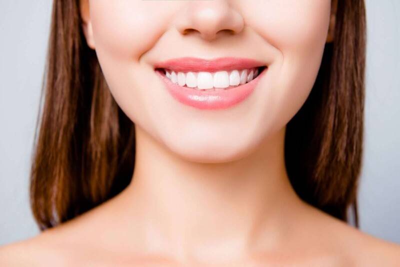 Teeth Whitening Chennai