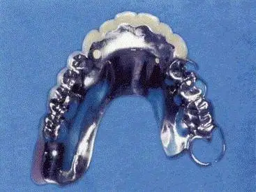 Painless Dental Procedures in Chennai