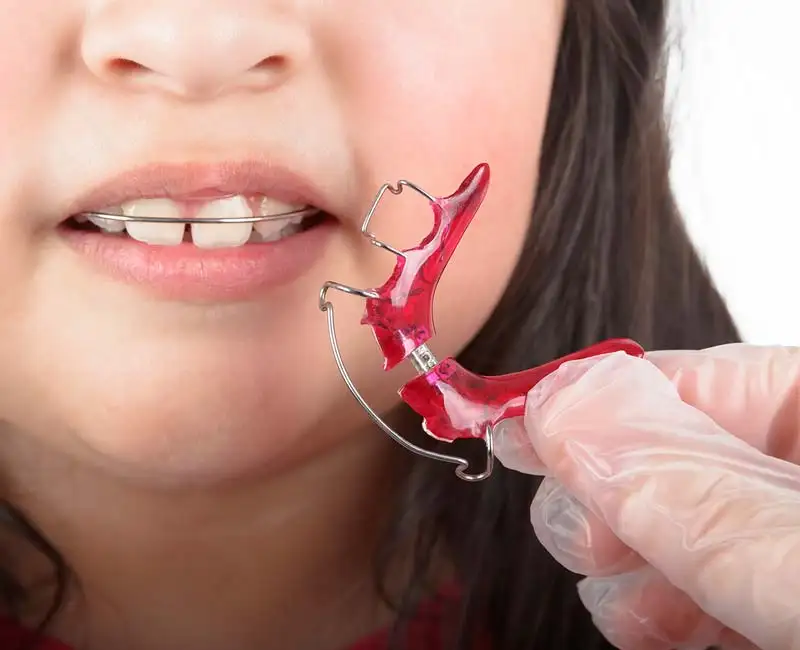 Best Dentist for Kids in Thoraipakkam