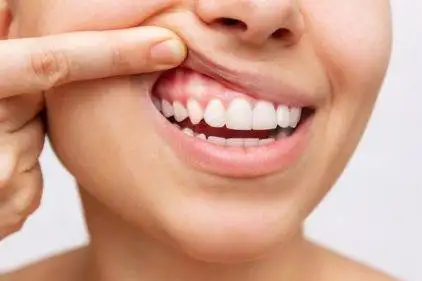 Best Dentist for Kids in Thoraipakkam