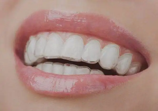 Best Dentist for Kids in Thoraipakkam