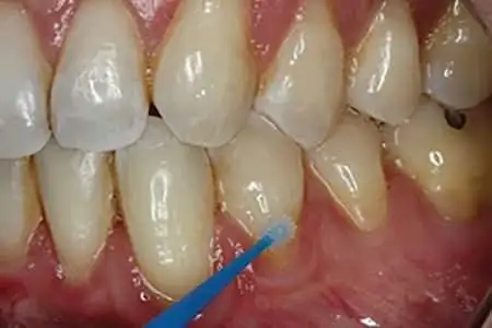 Mr. & Mrs. Tooth Dental Clinic Chennai