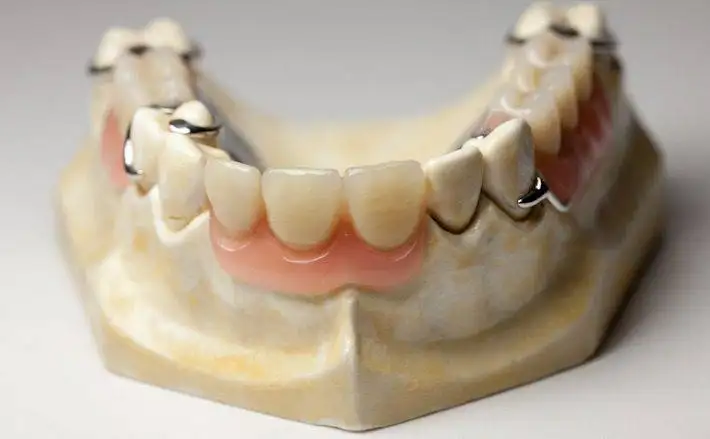 Painless Dental Procedures in Chennai