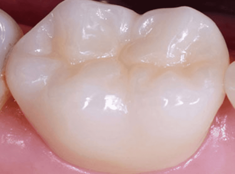 Emergency Dental Care Thoraipakkam