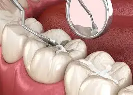 Best Dental Clinic for Smile Designing in Chennai
