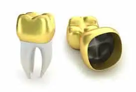 Painless Dental Procedures in Chennai