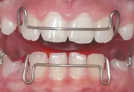 Best Dentist for Kids in Thoraipakkam