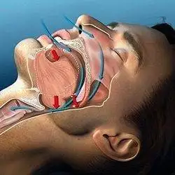 Affordable Dental Implants in Thoraipakkam