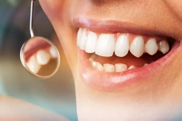 Painless Dental Procedures in Chennai