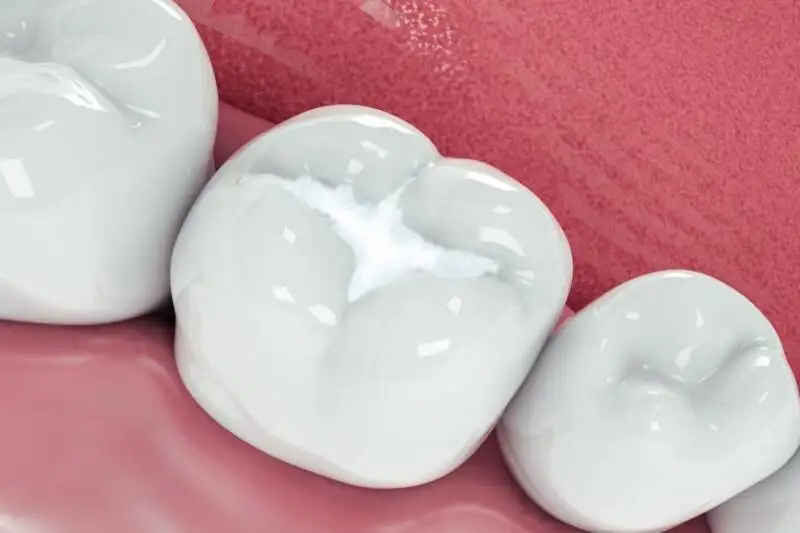 Best Dental Clinic for Smile Designing in Chennai