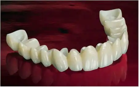 Painless Dental Procedures in Chennai