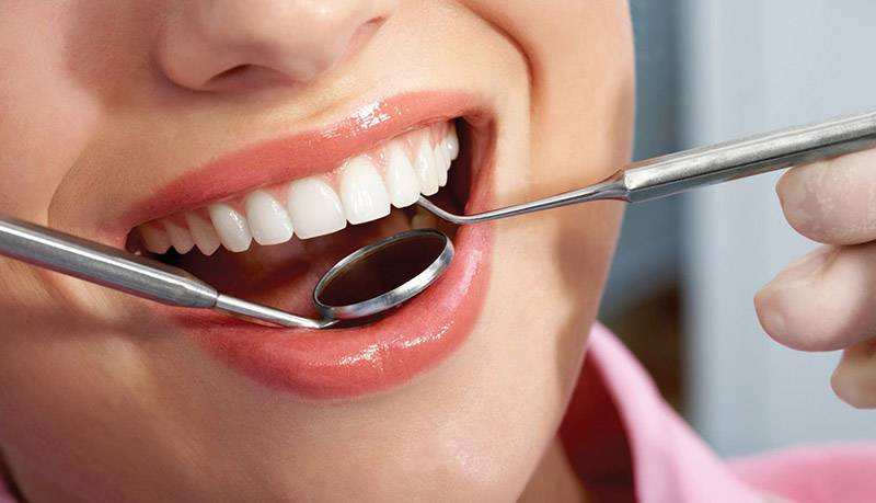 Scaling & Polishing: The Key to a Healthy Smile