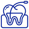 Invisible Aligners in Thoraipakkam