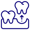 Invisible Aligners in Thoraipakkam